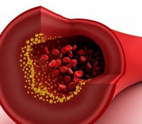 Anticoagulant Treatment